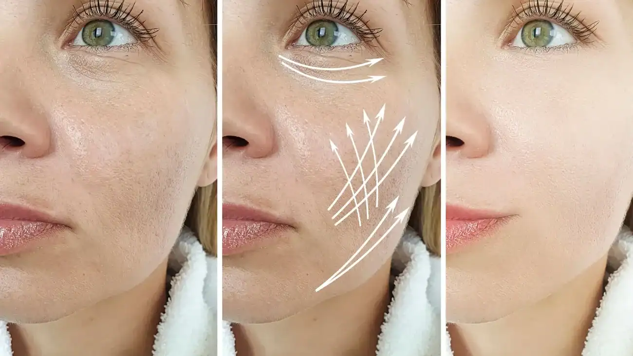 Can One Treatment Really Tackle More Than One Skin Concern Sunninghill?