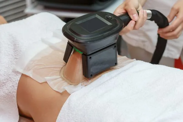 Image of person having fat freezing treatment to help weight gain Sunninghill