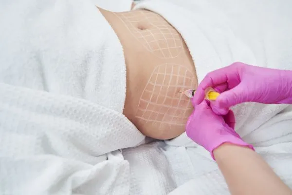 image of fat dissolving injections on love handles to help combat weight gain Sunninghill