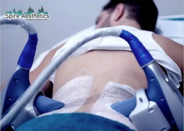 Man having fat freezing treatment done on love handles before a competitions Sunninghill to create a sculpted look.