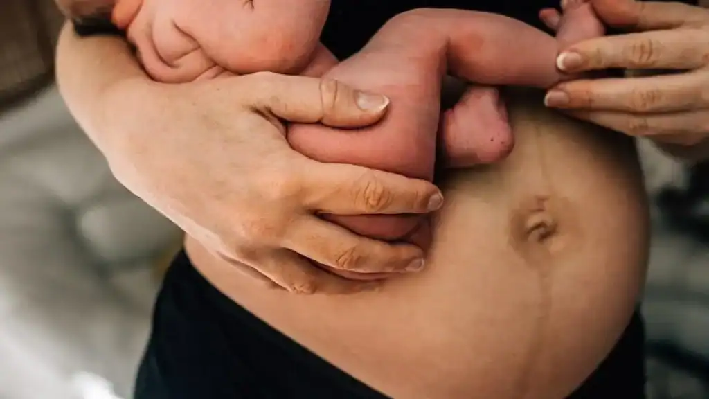 Why Is My Stomach Still Big After Pregnancy Sunninghill?